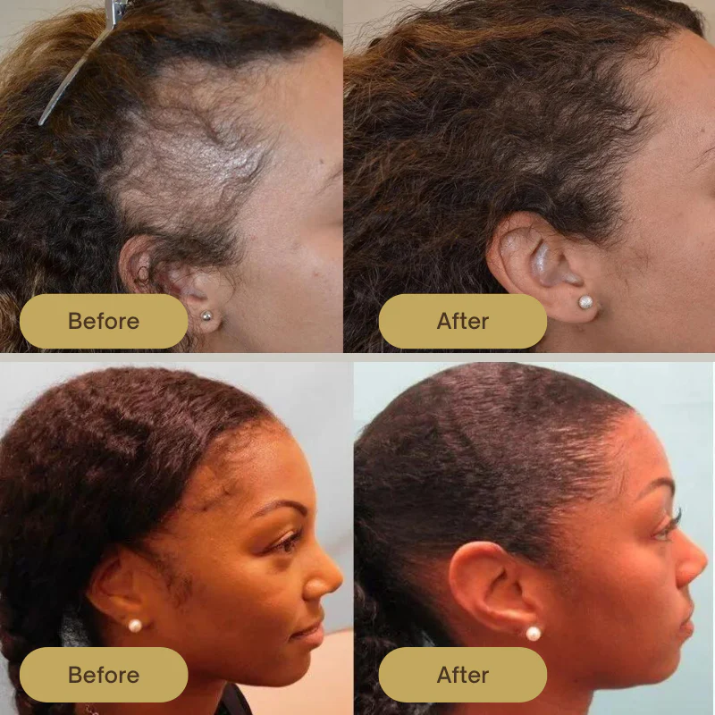 Houdini Vegan Hair Growth Oil - Image 4